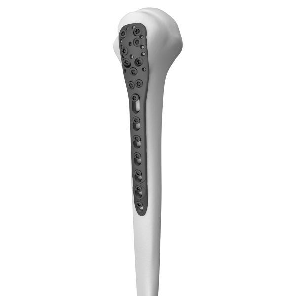 Proximal Humeral Locking Plate - Image 2