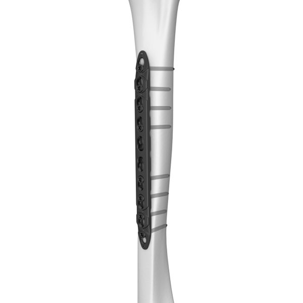 Humeral Shaft Straight Locking Plate - Image 4