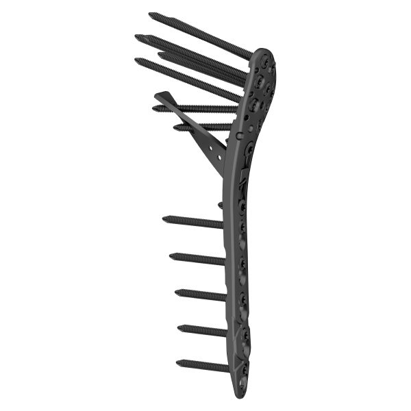 Proximal Humeral Locking Plate Ⅱ - Image 2