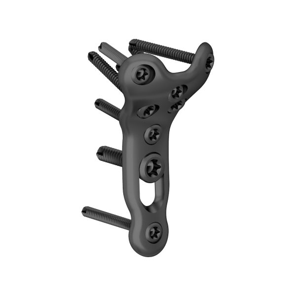 Proximal Radius Locking Plate - Image 3