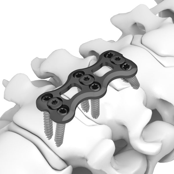 Anterior Cervical Plate - Image 3