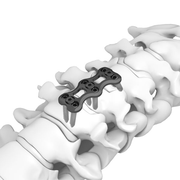 Anterior Cervical Plate - Image 2