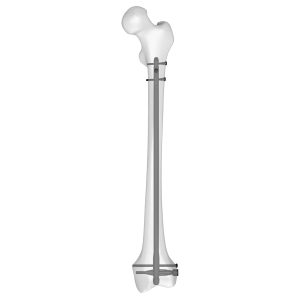 Distal Femoral Nail Long